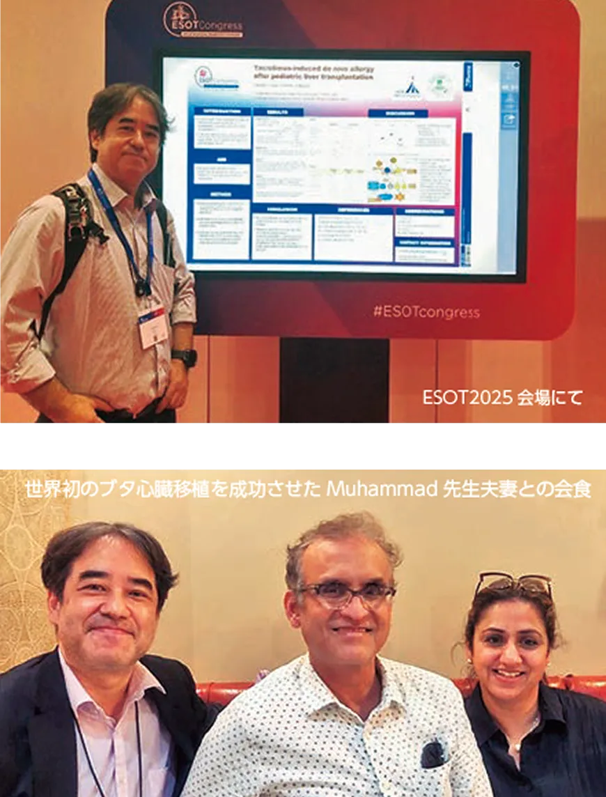 22nd Congress of the European Society for Organ Transplantation (ESOT) 2025 に参加して