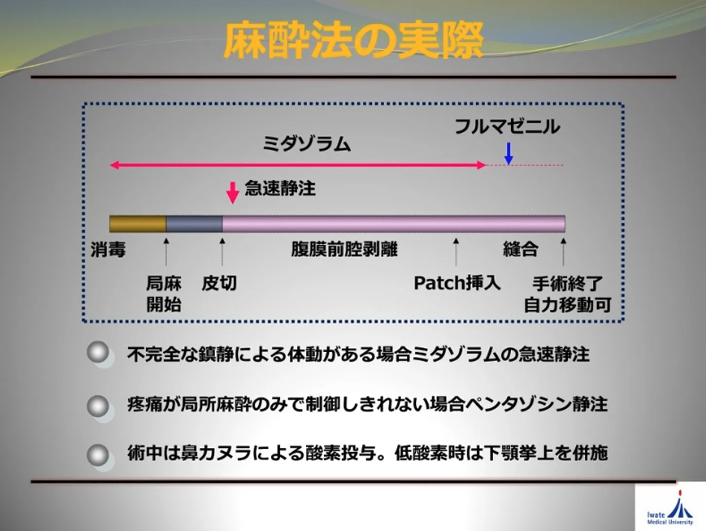 麻酔法の実際