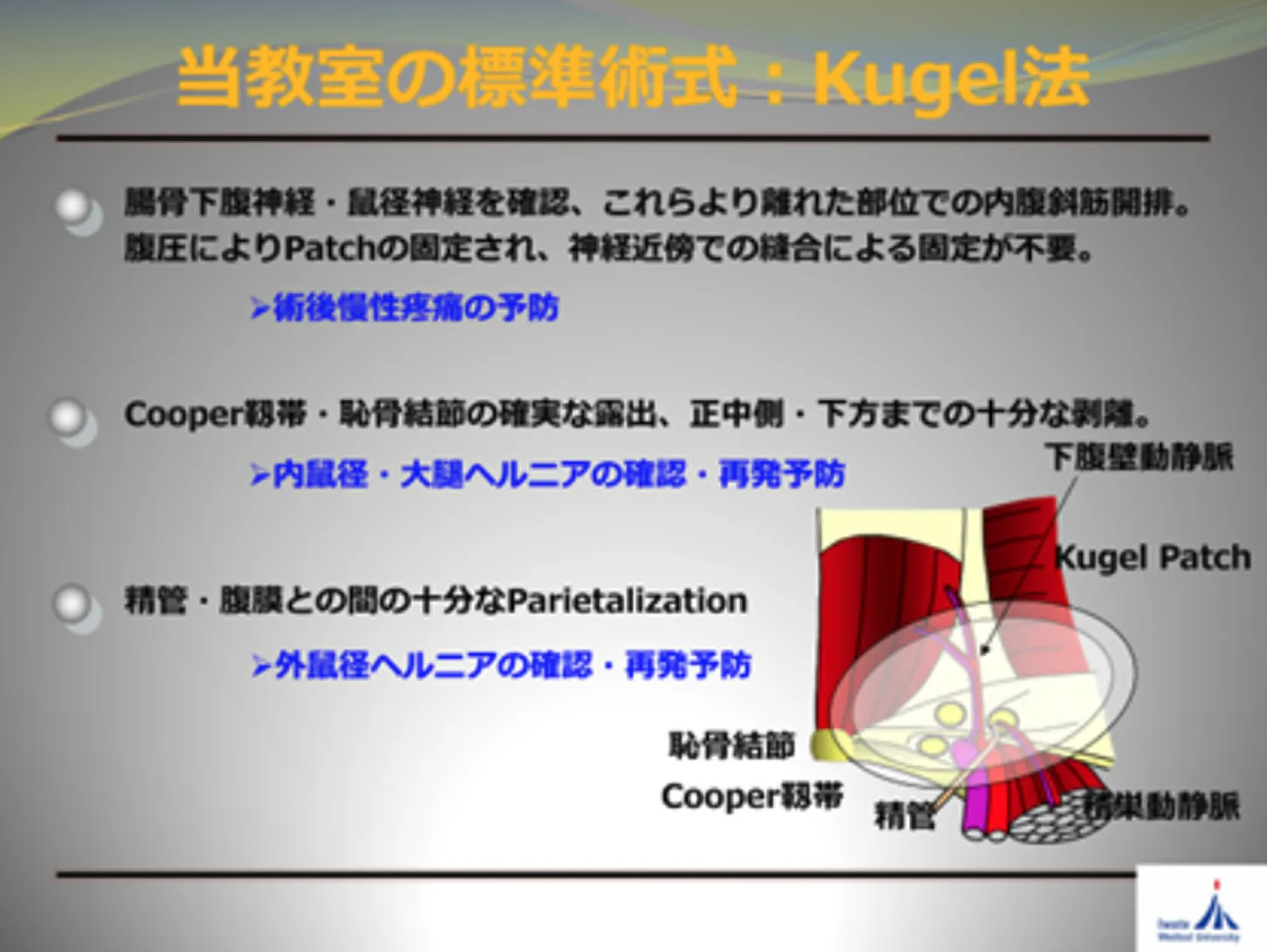 当教室の標準術式：Kugel法
