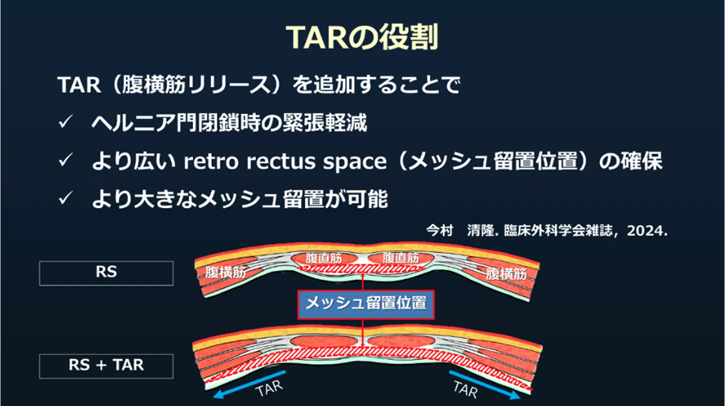 eTEP法
