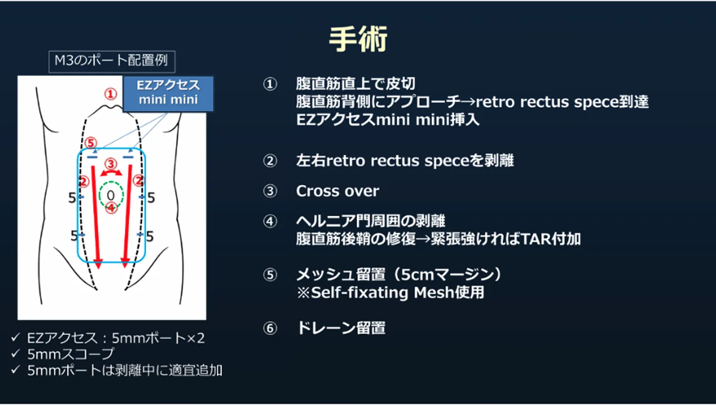 eTEP法