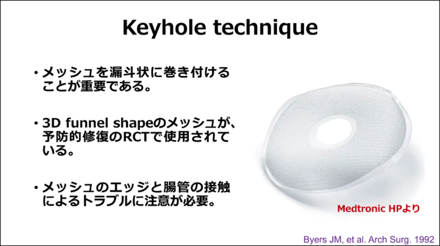 Keyholr technique