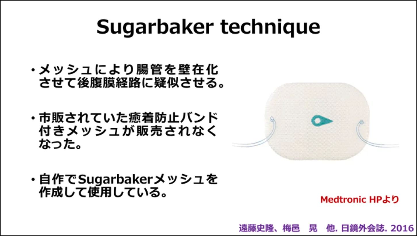 Sugarbaker technique